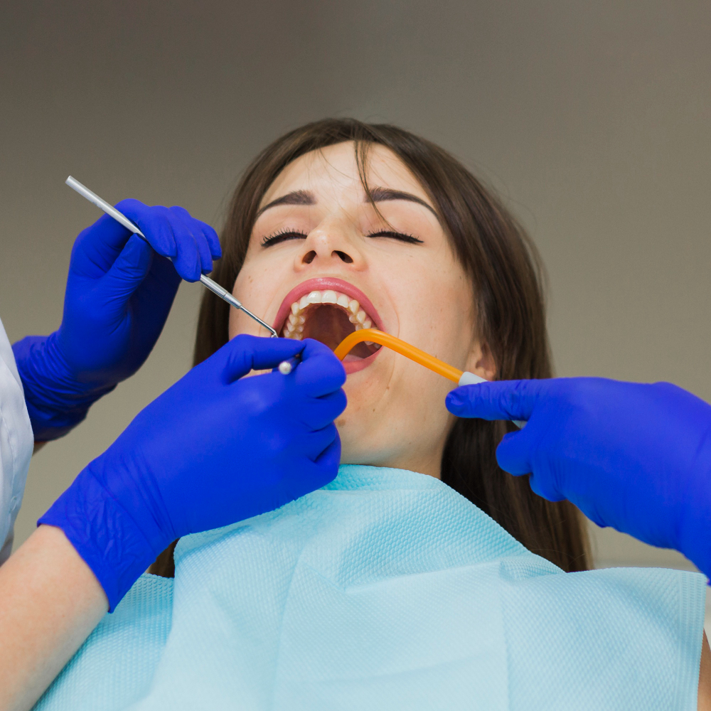Composite tooth filling procedure for restoring damaged teeth at RK Dental Practice Chandigarh.