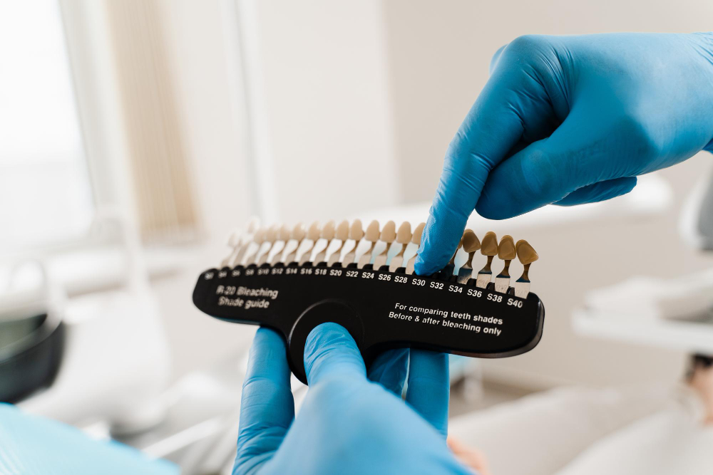 Dentist using a tooth shade guide to match the ideal tooth color during a smile design and cosmetic dentistry consultation.