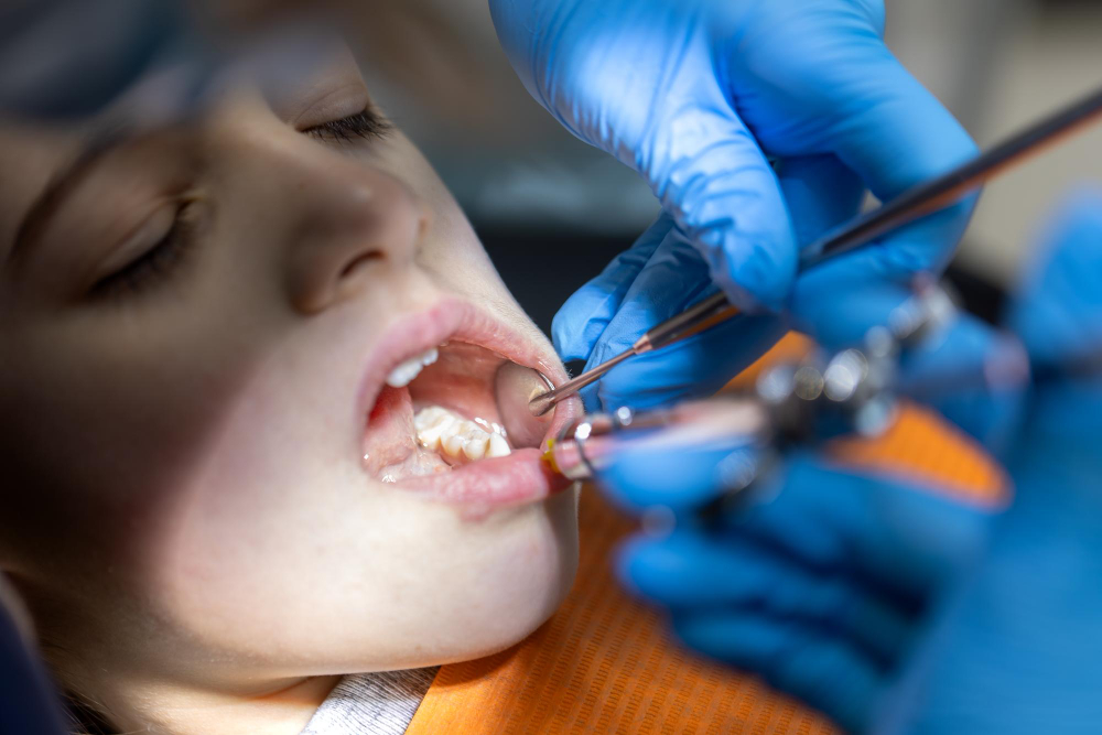 Painless wisdom tooth extraction performed by an experienced dentist in Chandigarh.