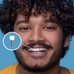 Root Canal Treatment