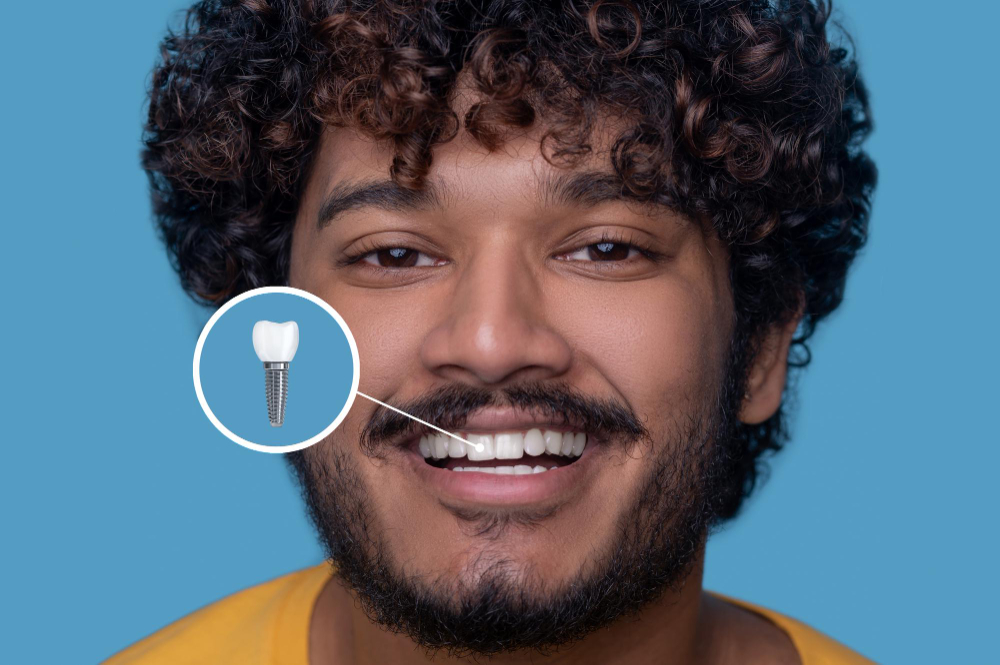 Root Canal Treatment