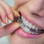 Braces vs Invisalign