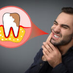 Pyorrhea Treatment in Chandigarh