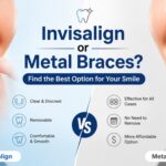Invisalign or Metal Braces?