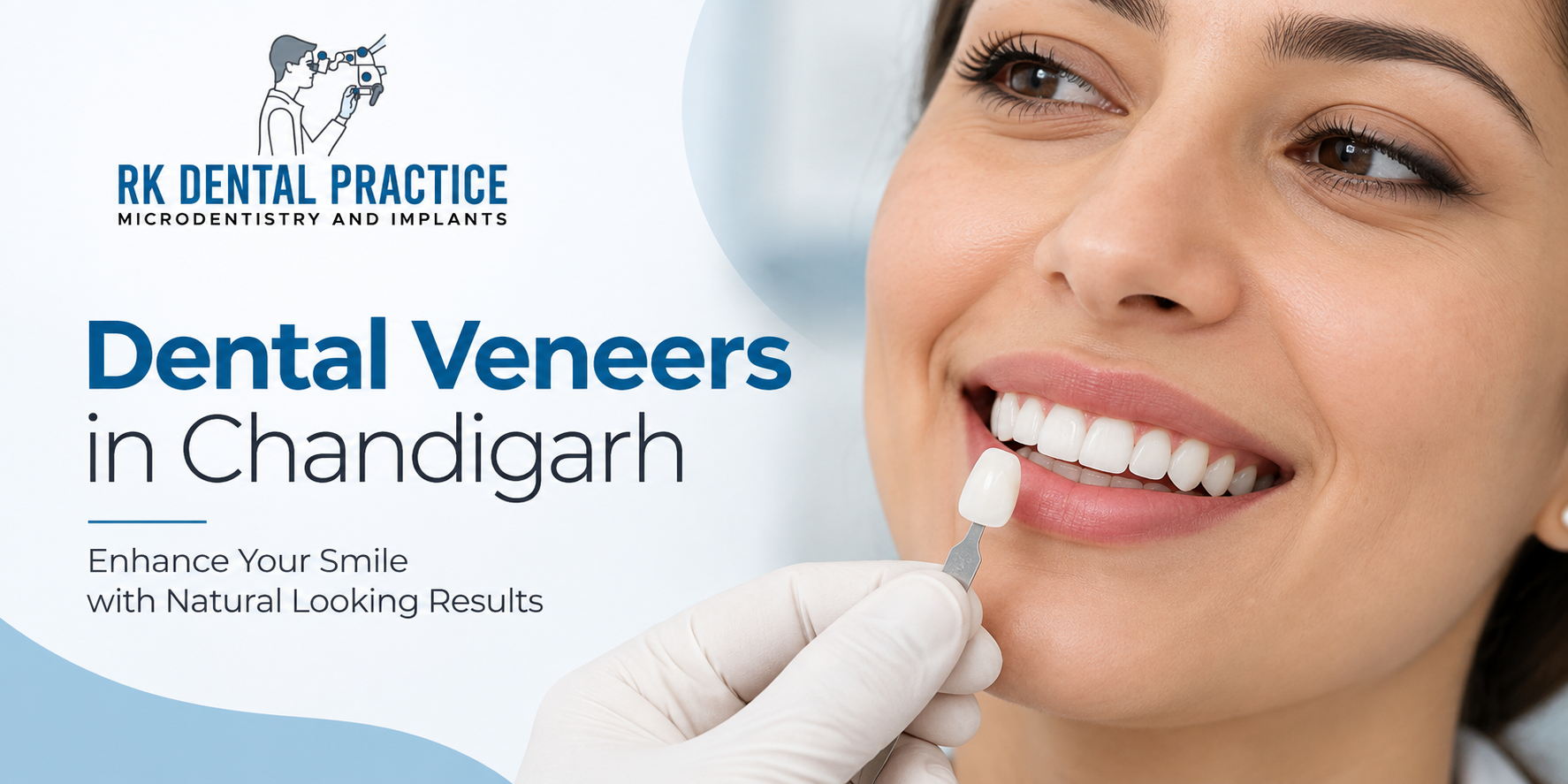 Dental Veneers in Chandigarh