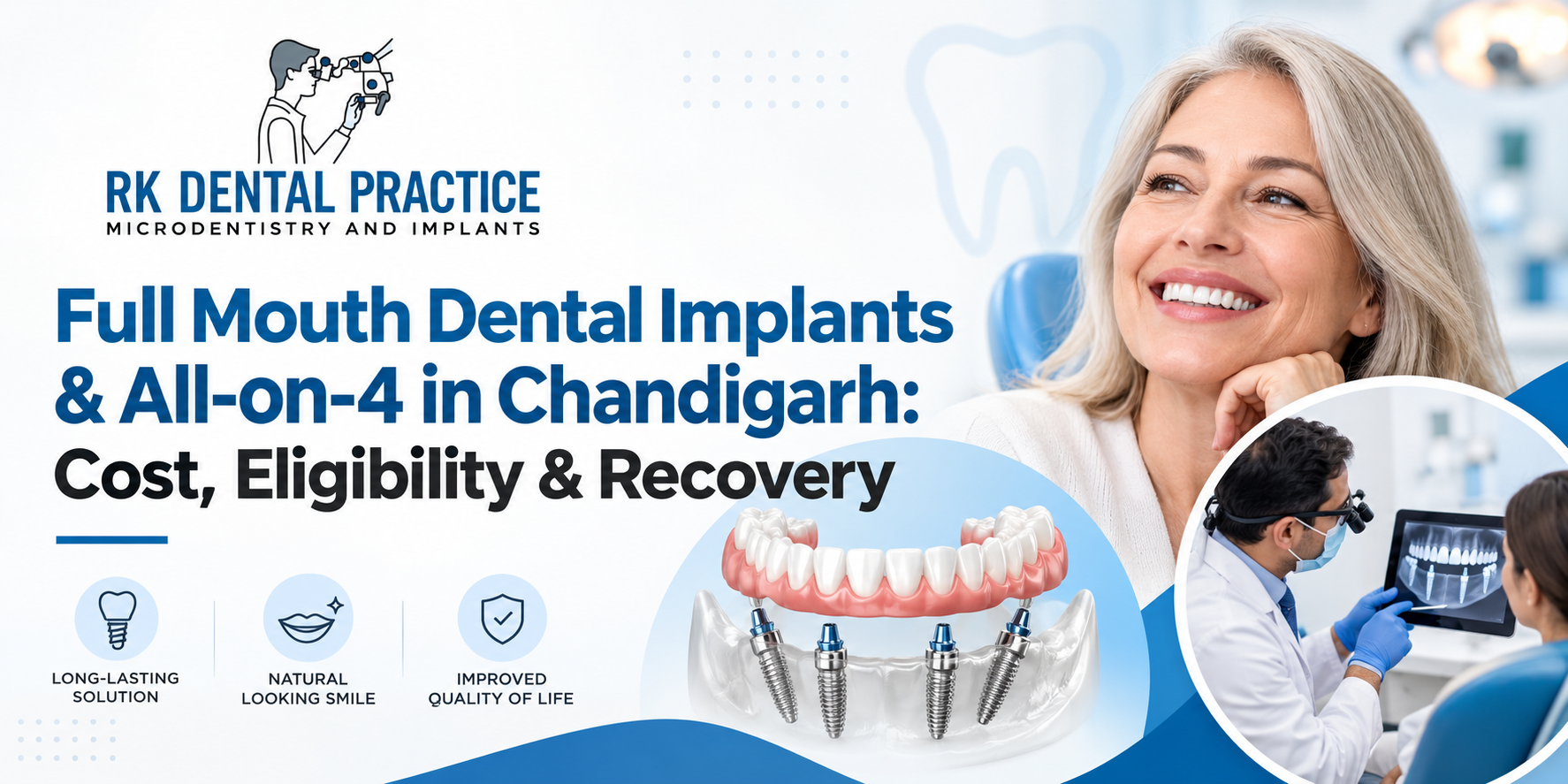 Full Mouth Dental Implants and All on 4 in Chandigarh by RK Dental Practice, featuring implant treatment, cost, eligibility, and recovery.