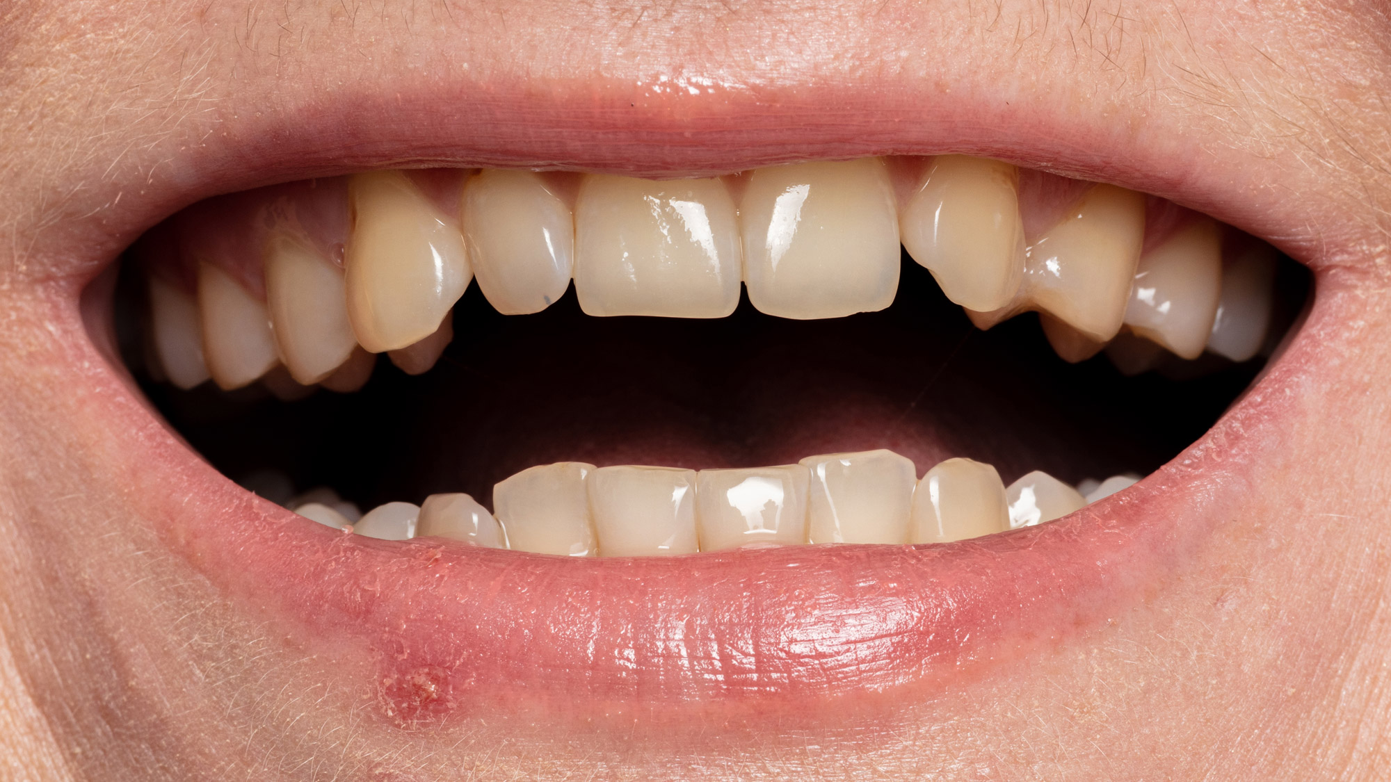 Smile before cosmetic dental treatment